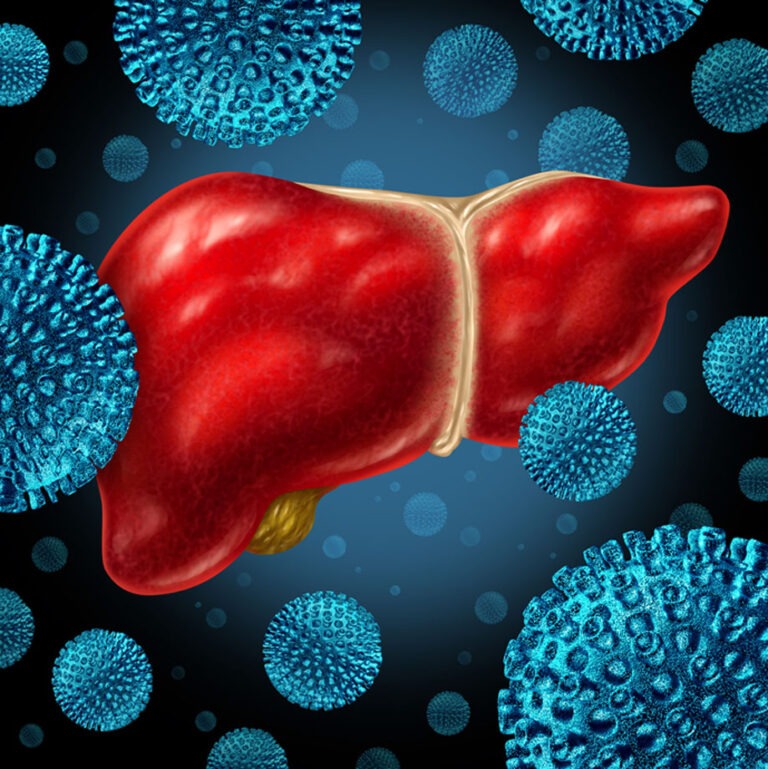 La Hepatitis: Una Enfermedad Silenciosa - MiSistemaInmune